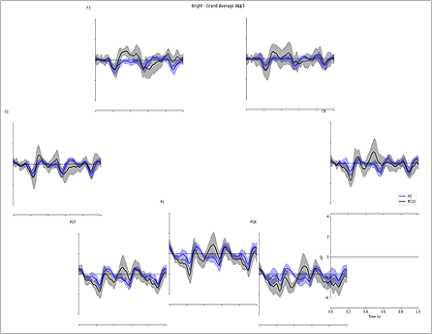 Figure 2: EEG comparison between the original image and the image with two levels of contrast worsened.