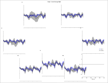 Figure 3: EEG comparison between the original image and an image with one level of contrast worsened.